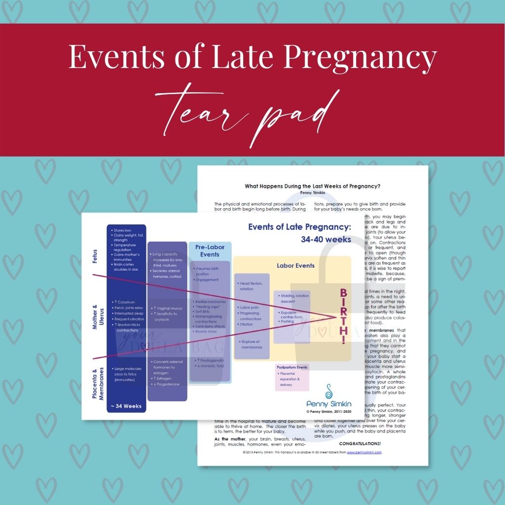 The Events of Late Pregnancy Tear Pad (pad of 50)